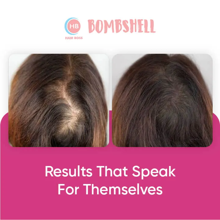 Bombshell Hair Growth Treatment For Women